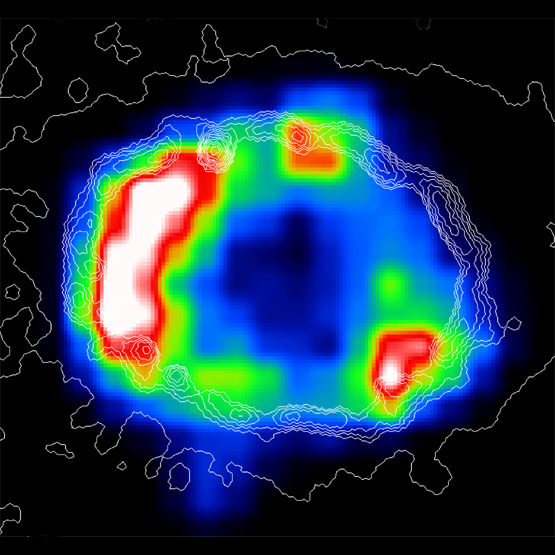 X-Ray Ring Around SN1987A