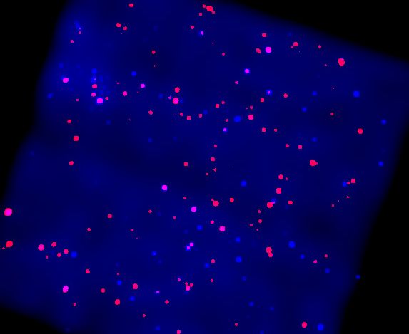 X-Rays from the Galactic Plane