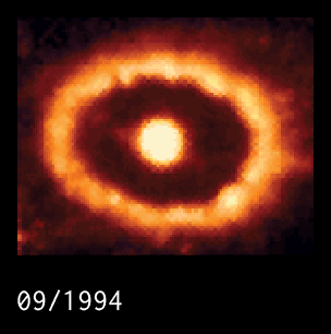 Shocked by Supernova 1987A