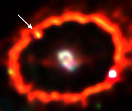 Shocked by Supernova 1987a