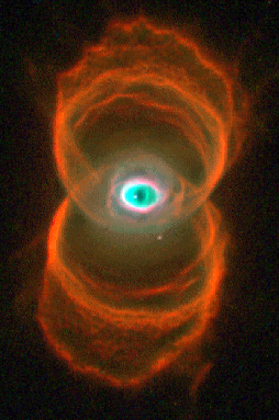 MyCn18: An Hourglass Nebula